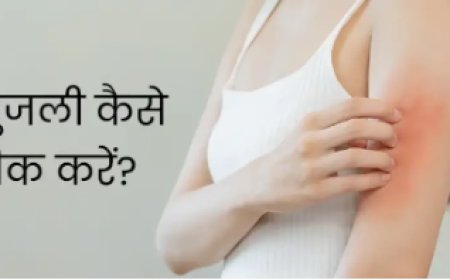 खुजली से छुटकारा: राहत पाने के लिए रामबाण घरेलू नुस्खे